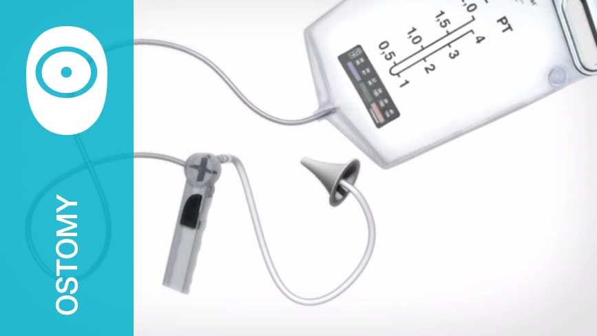 Food and beverage tips for colostomy ileostomy and 